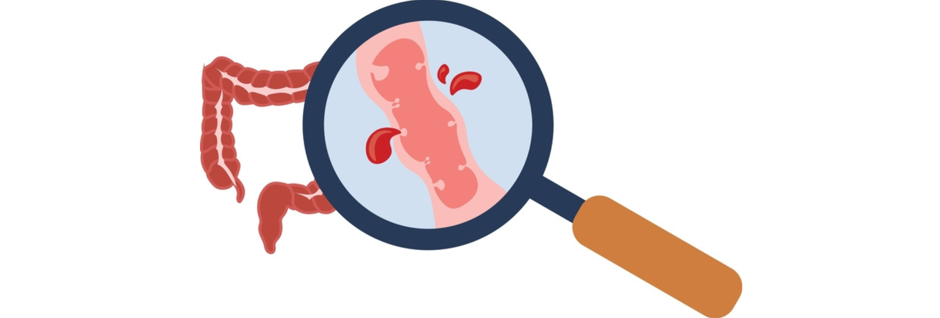 Αιμορραγία πεπτικού